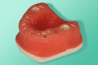 The edentulous jaw model is designed for training in immediate implant 10-5077