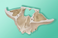 10-5044 Implanty pterygoidalne model